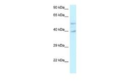 GRINL1A Rabbit anti-Human, Polyclonal, Novus Biologicals 0.1 mL | Buy Online | Novus Biologicals | Fisher Scientific